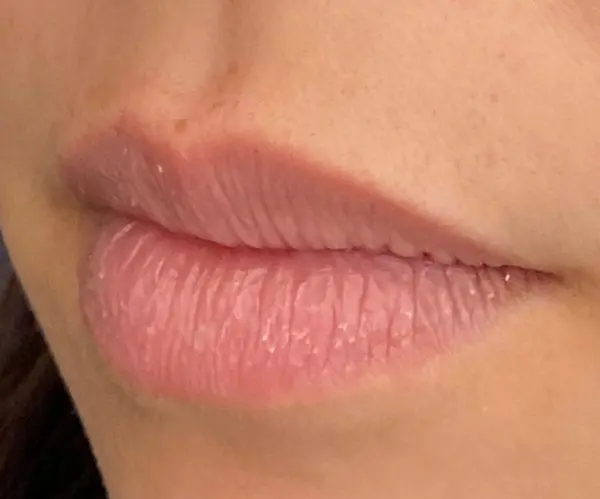 Lips before