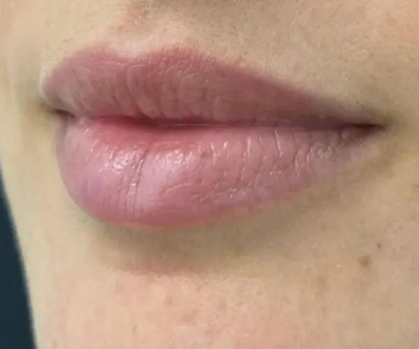 Lips after