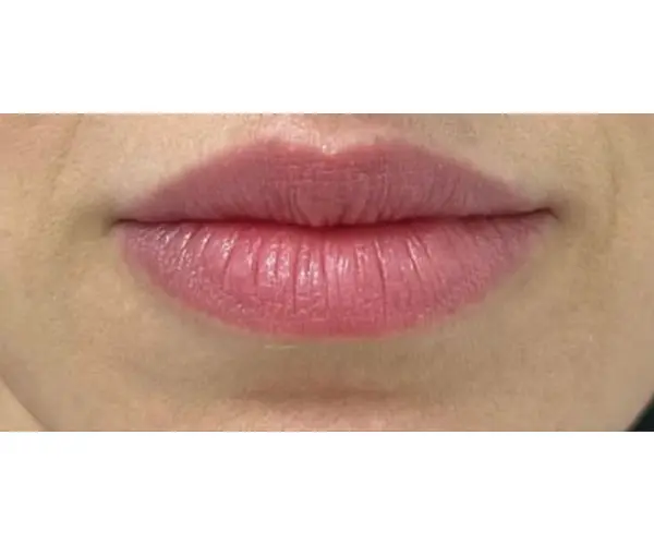 Lips after