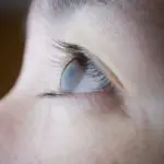 How To Tighten Eyelids