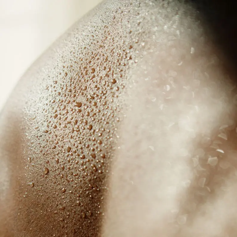 Excessive Sweating