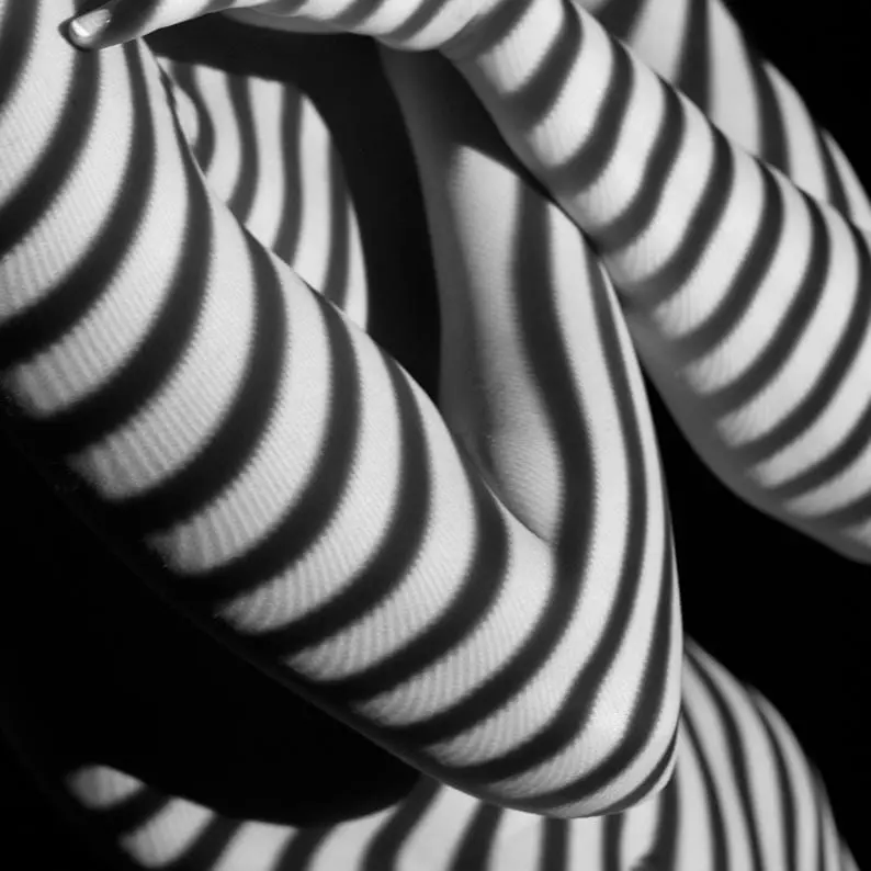 Cellulite Treatment London