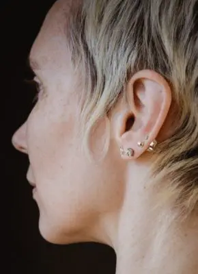 Neck Bands (Vertical) Treatment