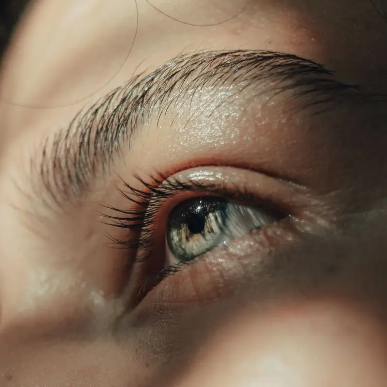 What Is A Brow Lift?