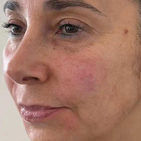 Dr Tatiana - BioFiller After