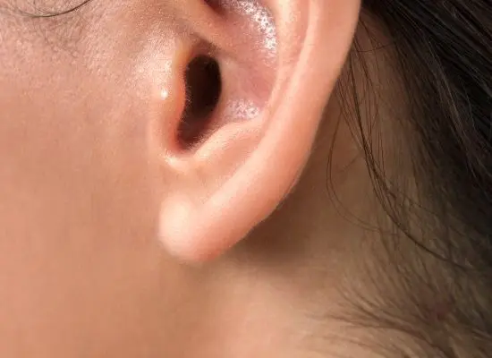 Can Torn or Stretched Earlobes Be Fixed?