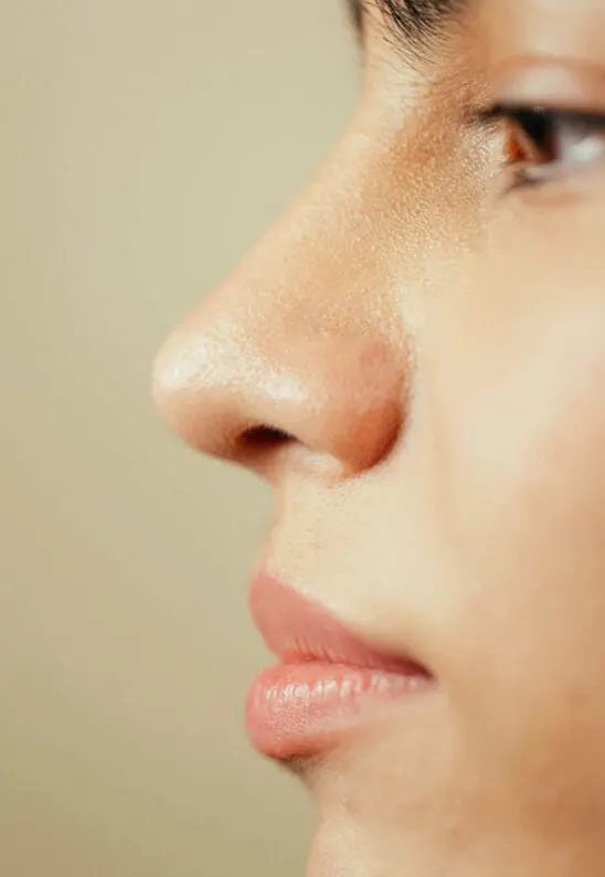 Rhinoplasty (‘Nose-Job’)