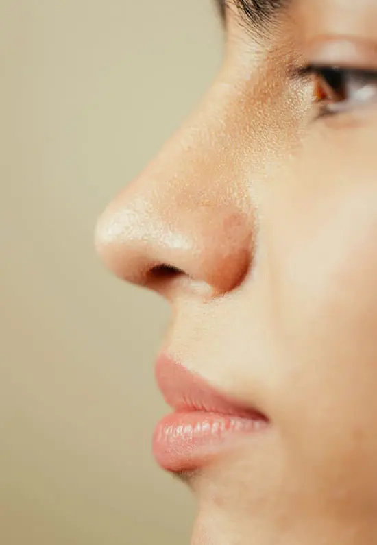 Rhinoplasty