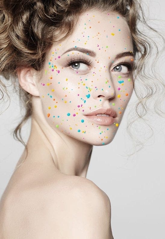 Acne Scars