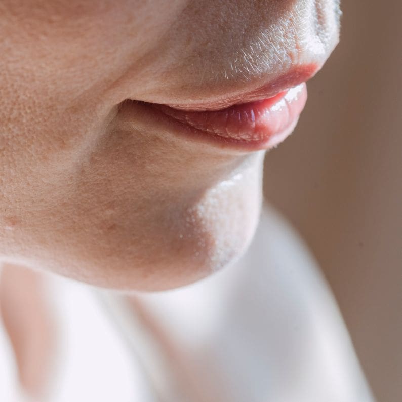 Prominent Chin