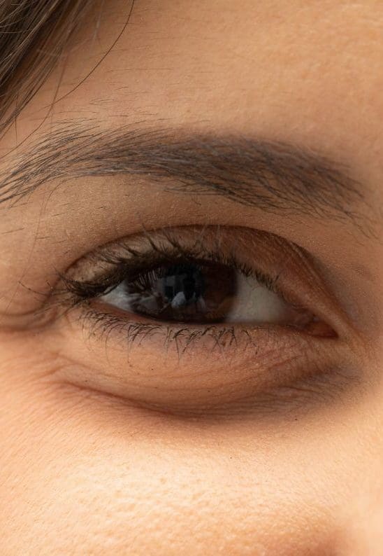 How To Get Rid Of Under Eye Bags - Into The Gloss | Into The Gloss