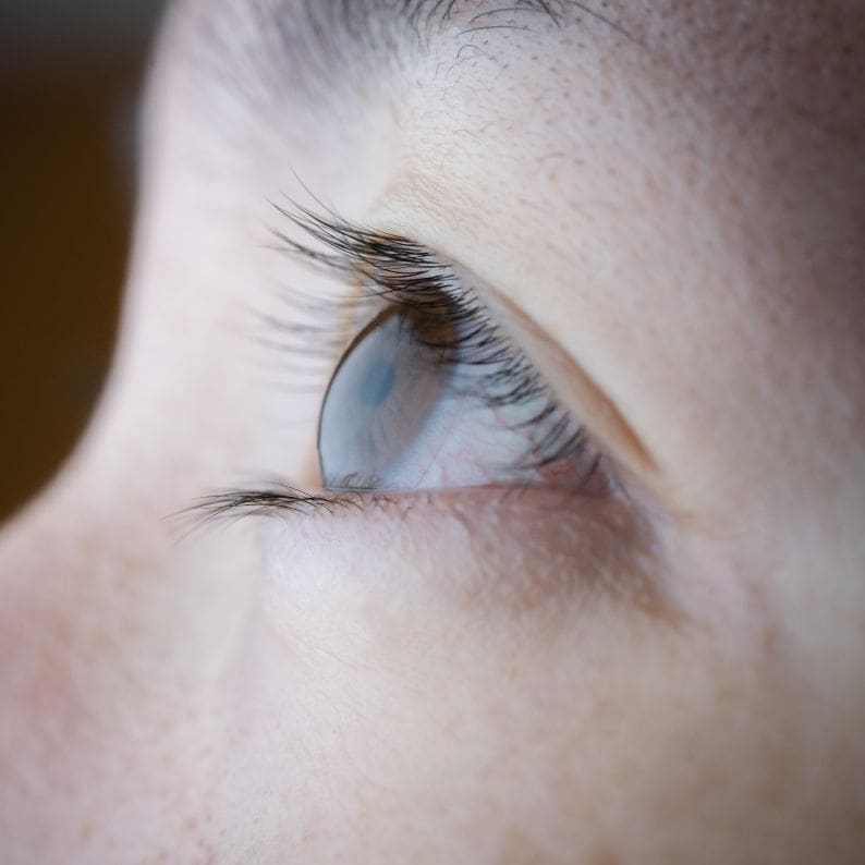 Sagging Eyelids Treatment London How to treat Sagging eyelids