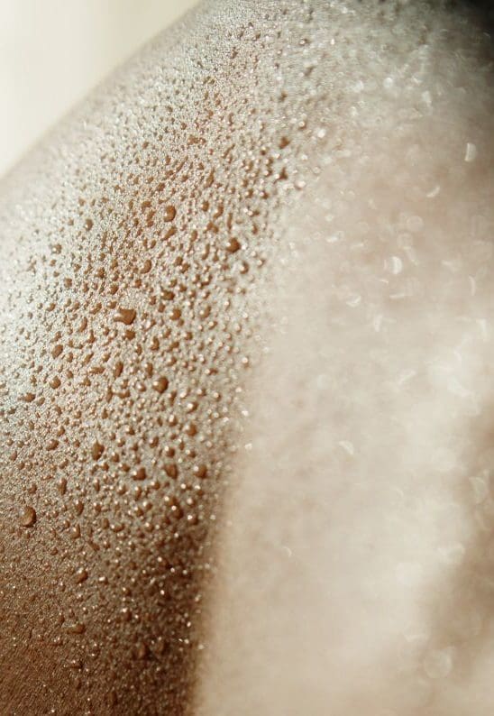 Overly Sweating Excessive Sweating Treatment London | Botox for Excess Sweating