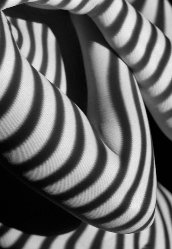 Cellulite